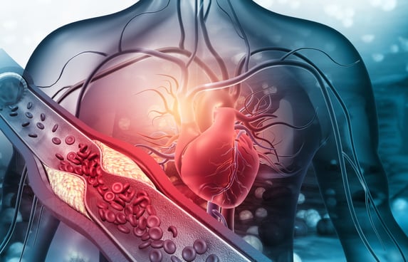 Concerned About Hyperlipidemia High Cholesterol 6902