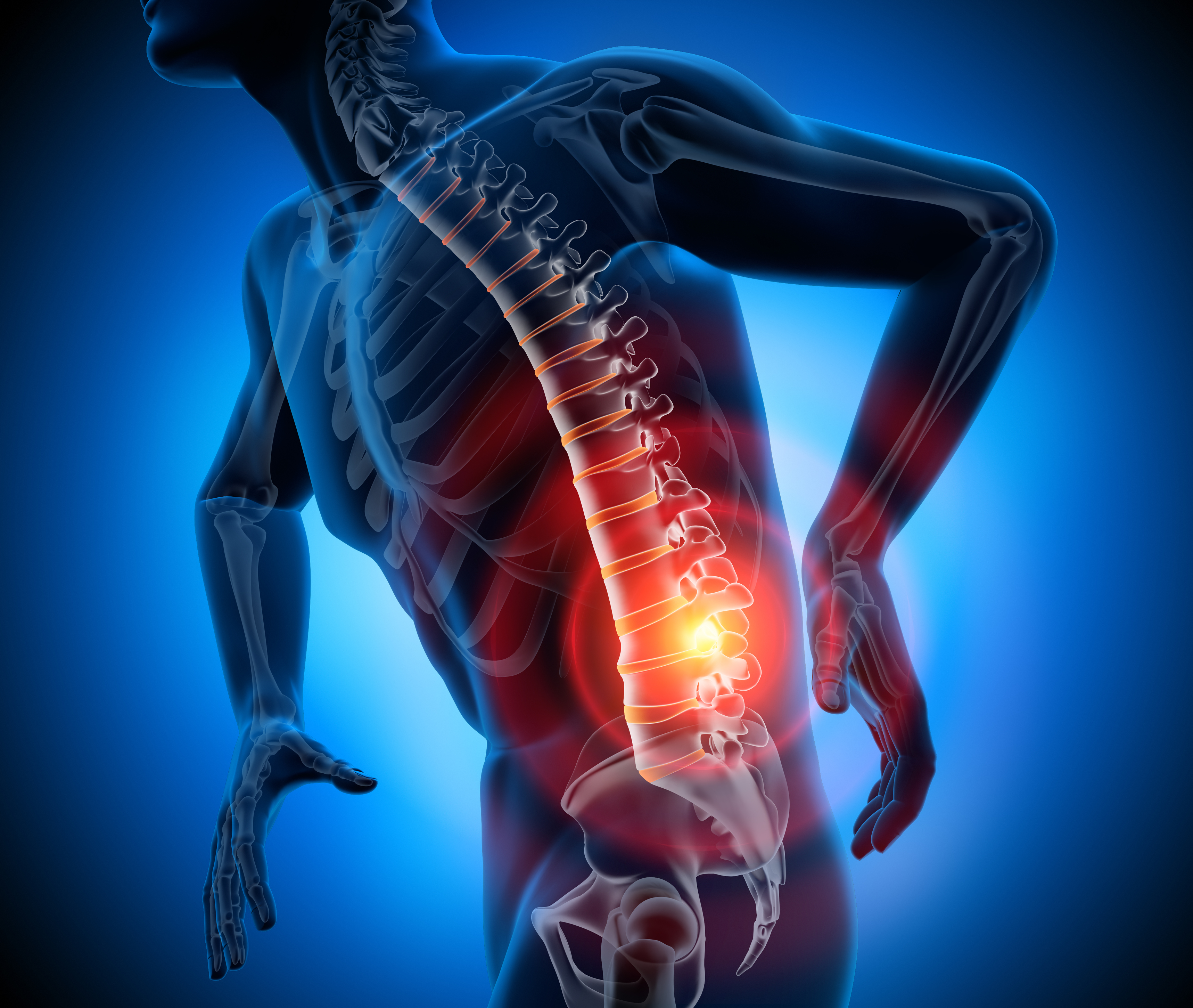 Understanding Chronic Back Pain